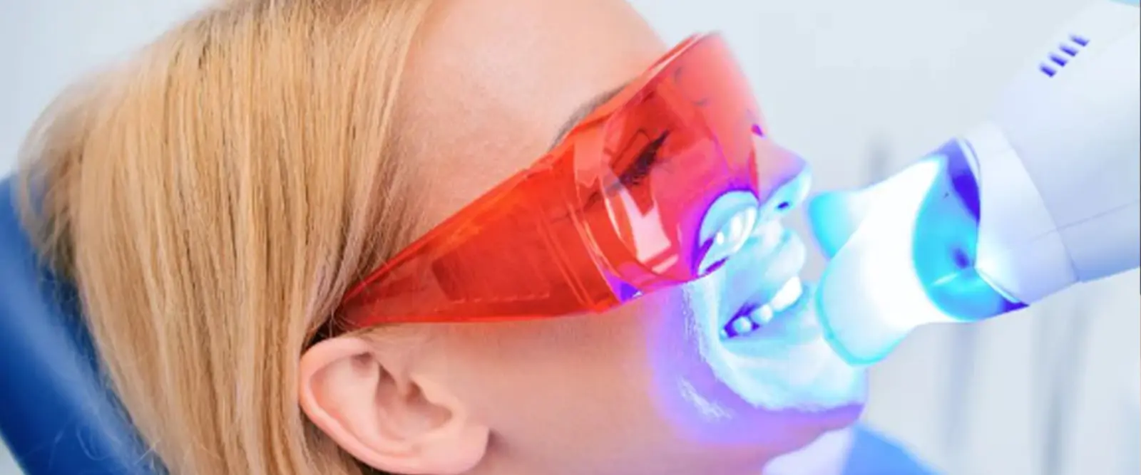 OEM ODM How to Start a Teeth Whitening Businesss5f