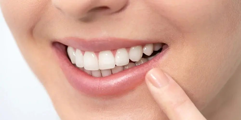 How Did We Get Our Start-teeth-whitening-178