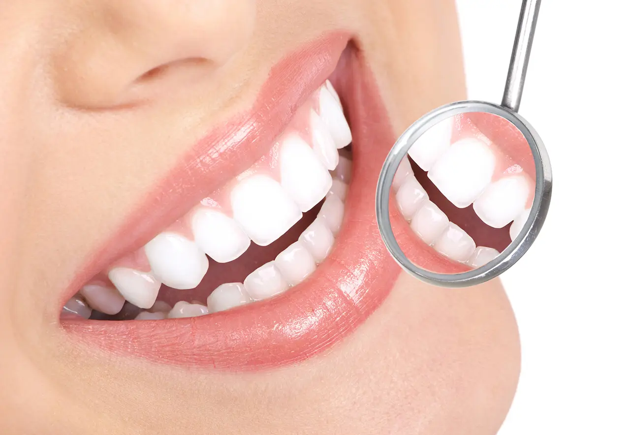 Teeth whitening mouth tray whitening teeth0qw