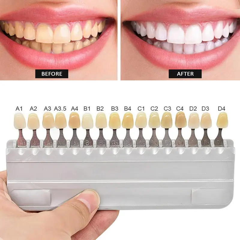 Teeth whitening shade guide GW-SGV16 03.jpg