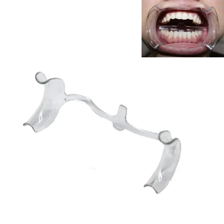 Teeth Whitening or Dental Cheek Retra...